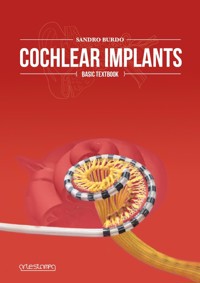 Cochlear Implants - Basic Textbook - Sandro Burdo - E-Book