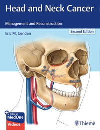Head and Neck Cancer -  - E-Book