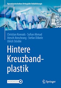Hintere Kreuzbandplastik - Christian Konrads - E-Book