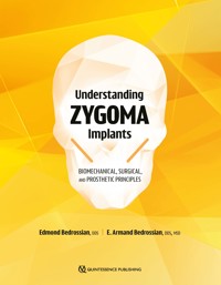 Understanding Zygoma Implants - Edmond Bedrossian - E-Book