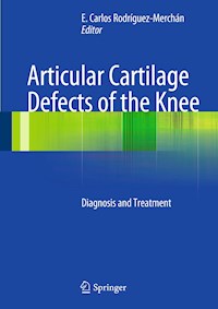 Articular Cartilage Defects of the Knee - - E-Book