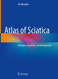 Atlas of Sciatica - Ali Akhaddar - E-Book