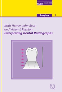 Interpreting Dental Radiographs - Keith Horner - E-Book