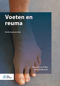 Voeten en reuma - Margreet van Putten - E-Book