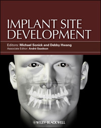 Implant Site Development -  - E-Book