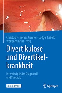 Divertikulose und Divertikelkrankheit -  - E-Book