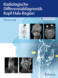 Radiologische Differenzialdiagnostik Kopf-Hals-Region -  - E-Book