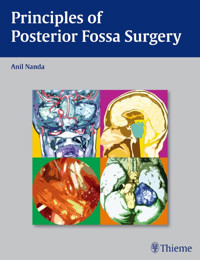 Principles of Posterior Fossa Surgery - - E-Book