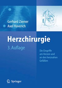 Herzchirurgie -  - E-Book