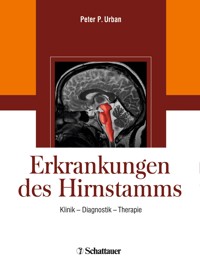 Erkrankungen des Hirnstamms -  - E-Book