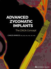 Advanced Zygomatic Implants - Carlos Aparicio - E-Book