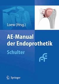 AE-Manual der Endoprothetik -  - E-Book