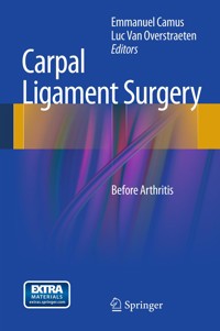 Carpal Ligament Surgery -  - E-Book