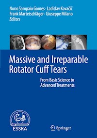 Massive and Irreparable Rotator Cuff Tears - - E-Book