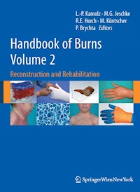 Handbook of Burns Volume 2 -  - E-Book