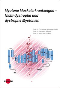 Myotone Muskelerkrankungen – Nicht-dystrophe und dystrophe Myotonien - Christiane Schneider-Gold - E-Book