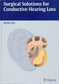 Surgical Solutions for Conductive Hearing Loss - Mirko Tos - E-Book