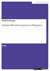 Immune Thrombocytopenia in Pregnancy - Patrick Kimuyu - E-Book