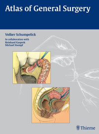 Atlas of General Surgery - Volker Schumpelick - E-Book