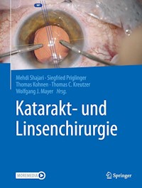 Katarakt- und Linsenchirurgie -  - E-Book