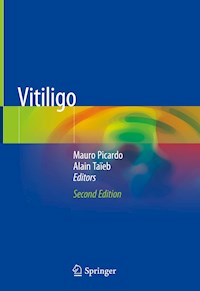 Vitiligo -  - E-Book