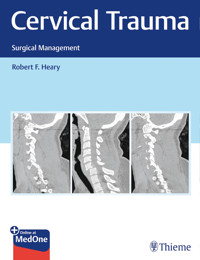 Cervical Trauma - Robert Heary - E-Book