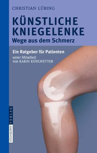 Künstliche Kniegelenke - C. Lüring - E-Book