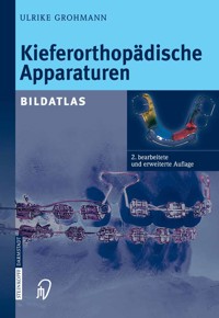 Kieferorthopädische Apparaturen - Ulrike Grohmann - E-Book