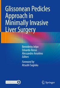 Glissonean Pedicles Approach in Minimally Invasive Liver Surgery - - E-Book