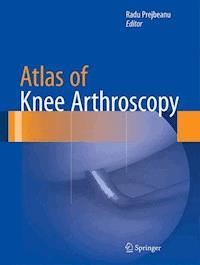 Atlas of Knee Arthroscopy -  - E-Book