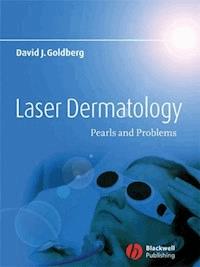 Laser Dermatology - David J. Goldberg - E-Book