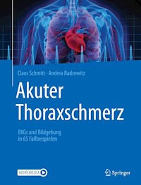 Akuter Thoraxschmerz - Claus Schmitt - E-Book