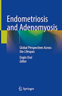 Endometriosis and Adenomyosis -  - E-Book