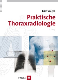Praktische Thoraxradiologie - Erich Voegeli - E-Book