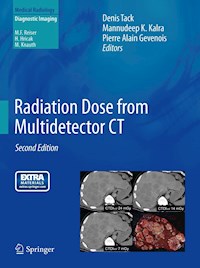 Radiation Dose from Multidetector CT -  - E-Book