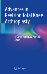 Advances in Revision Total Knee Arthroplasty -  - E-Book