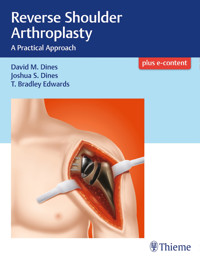 Reverse Shoulder Arthroplasty - David M. Dines - E-Book