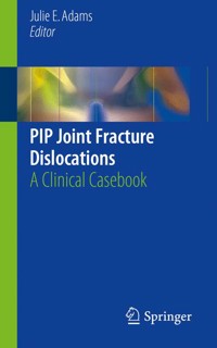 PIP Joint Fracture Dislocations -  - E-Book