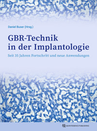 GBR-Technik in der Implantologie -  - E-Book