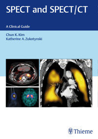 SPECT and SPECT/CT - Chun Kim - E-Book