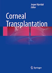 Corneal Transplantation -  - E-Book
