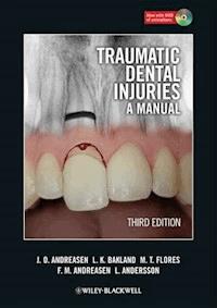 Traumatic Dental Injuries - Jens O. Andreasen - E-Book