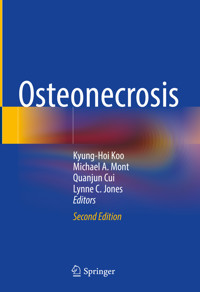 Osteonecrosis -  - E-Book