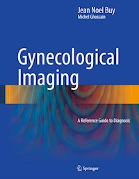 Gynecological Imaging - Jean Noel Buy - E-Book