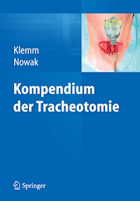 Kompendium der Tracheotomie -  - E-Book