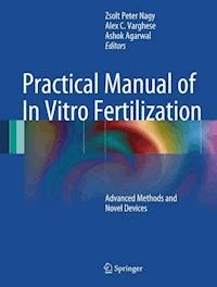 Practical Manual of In Vitro Fertilization -  - E-Book