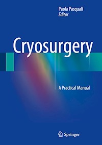 Cryosurgery -  - E-Book