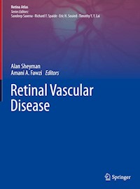 Retinal Vascular Disease -  - E-Book