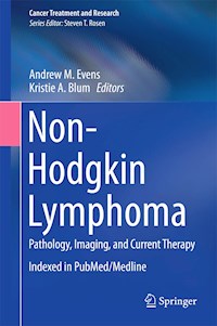 Non-Hodgkin Lymphoma -  - E-Book