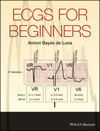 ECGs for Beginners - Antoni Bayés de Luna - E-Book